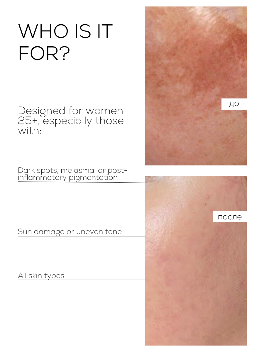 AMPOULES FOR PIGMENTATION, MELASMA & POST-ACNE MARKS
